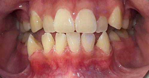 Before treatment