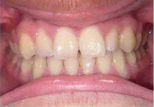 Before treatment