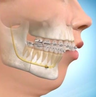 Craniofacial orthodontic model